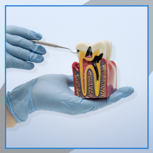 Endodontic Condensers
