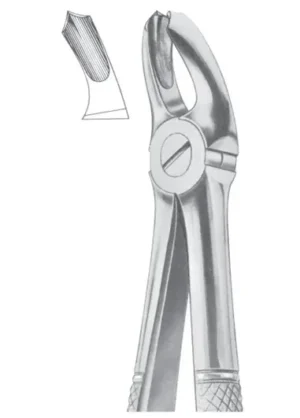 Upper molars